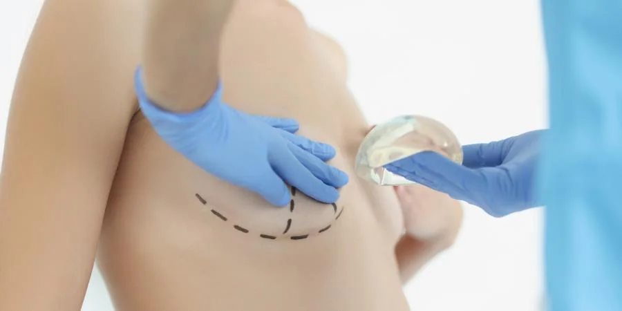 solucion mamas tuberosas con cirugia
